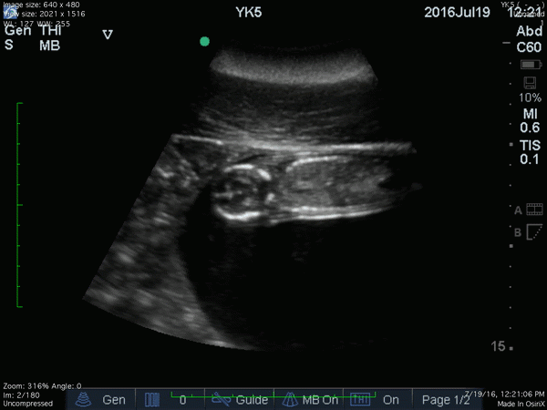An animated image of a dolphin fetus during a reproductive ultrasound.